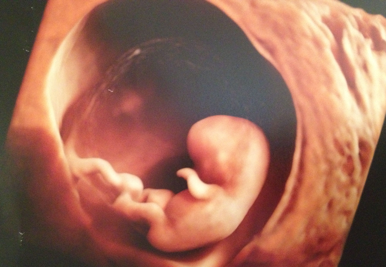 10 неделя что нового. Эмбрион на 10 неделе беременности УЗИ. УЗИ 10 недель беременности.